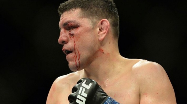 Ngay cả HLV cũng chẳng tin Nick Diaz