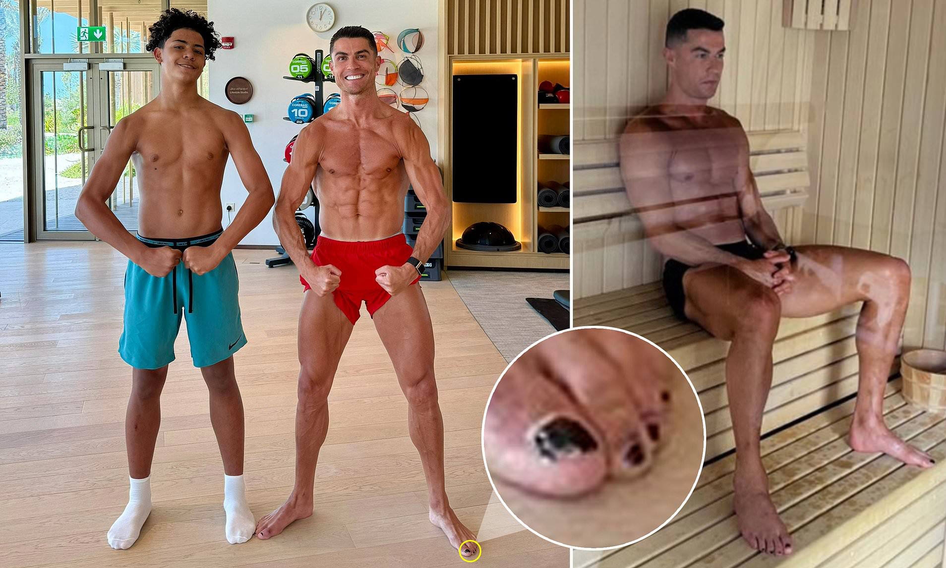 Ronaldo mong chan 01