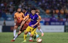 Bầm dập vì HAGL, sao Hà Nội FC tiết lộ tình trạng chấn thương