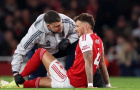 Arsenal lo sốt vó: Ben White chấn thương, nghỉ 4–6 tuần