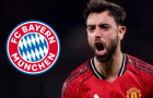 Vì sao Man Utd nên giữ chân Bruno thay vì bán cho Bayern?