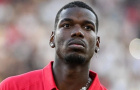 Monaco cân nhắc thanh lý Pogba vì chấn thương dai dẳng
