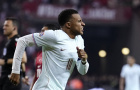 Zidane giải thích lý do khiến Mbappe chấn thương