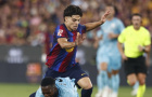 CHÍNH THỨC! Barcelona trói chân Xavi Espart đến năm 2030