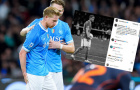 Kevin De Bruyne báo tin phẫu thuật thành công, gửi lời tri ân đến người hâm mộ