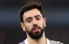 Mất Bruno Fernandes, Manchester United lao đao giữa cơn bão chấn thương