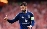 Man United cần chuẩn bị cho kịch bản không Bruno Fernandes