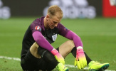 Joe Hart: Từ số 1 trở thành người thừa