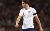 Tarkowski hết hi vọng dự World Cup 2018 cùng Tam Sư