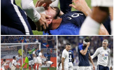 Lãnh trọn cú đấm của thủ thành tuyển Mỹ, Oliver Giroud đổ máu, gục xuống sân