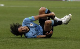 Edinson Cavani cần 'phá hủy y học' nếu muốn tử chiến với Pháp