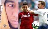 Nguy cho Liverpool, chấn thương của Firmino vẫn chưa thuyên giảm