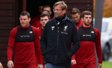 Jurgen Klopp lên tiếng về lực lượng Liverpool trong trận gặp Napoli và Man City