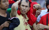 AFF Cup và top 6 'trò bẩn' khiến Đông Nam Á muối mặt