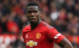 Pogba và nỗi khổ tâm của các giá 89 triệu bảng