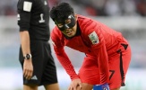 Son Heung-min gặp sự cố ở trận gặp Uruguay