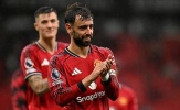 Bruno Fernandes đang đặt Man United vào tình thế khó xử