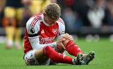 Bão chấn thương: Mối lo và cơ hội của Arsenal ở Ngoại hạng Anh