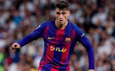 Pedri nguy cơ nghỉ 10 trận vì chấn thương gân kheo, , Barcelona lao đao