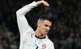 Thẻ đỏ của Ronaldo: Vì sao cú vung tay ở Dublin gây chấn động?