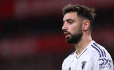 Bồ Đào Nha lặp lại “ác mộng” Man Utd khi thiếu Bruno Fernandes