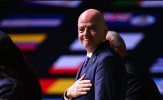 Infantino tuyên bố 150 nước mất bóng đá nếu thiếu tiền vé World Cup