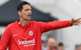 Soi trận Frankfurt vs Leverkusen: Chủ nhà bất ổn