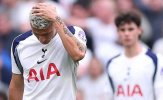 Tottenham rơi xuống nhóm cầm đèn đỏ và hồi chuông báo động