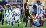 FIFA điều tra Argentina sau World Cup 2026