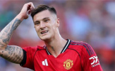 Sesko chưa thể tái xuất trong trận MU gặp Leeds