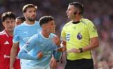 Maresca cho rằng Bruno Fernandes cũng phải nhận thẻ đỏ