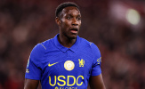 Chelsea phải chấp nhận thỏa hiệp nếu muốn trông cậy vào Welbeck