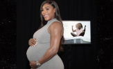XÁC NHẬN: Serena Williams đã 'khai hoa nở nhụy'
