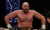 Đây là phản ứng của Tyson Fury khi được chủ tịch WBO đề nghị đấu với tay đấm 6-0 Bakhodir Jalolov