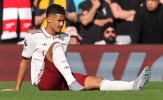 Arsenal đối mặt thách thức lớn khi Saliba chấn thương