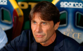 Conte phản pháo chỉ trích, bảo vệ Napoli giữa tâm bão hoài nghi