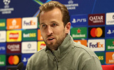Harry Kane giữ sự điềm tĩnh sau thất bại, Bayern tập trung cho hành trình dài hạn
