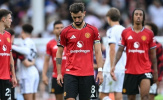 Tuyến giữa Man United: Lỗ hổng chí mạng lộ rõ sau trận hòa Fulham