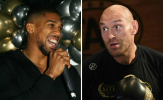 Anthony Joshua mượn Conor McGregor cà khịa Tyson Fury