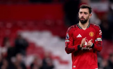 Bruno Fernandes vắng mặt trước Wolves, Amorim ca ngợi tinh thần thủ lĩnh
