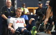 Harry Kane chấn thương, Tottenham lo sốt vó