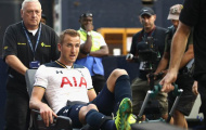 Nguy to cho Tottenham: Harry Kane có khả năng nghỉ hết 2016