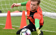 Vị trí thủ môn làm Jurgen Klopp đau đầu