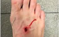 Suarez đáp trả Filipe Luis sau màn công kích trên MXH