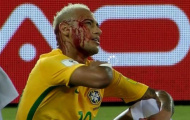 'Gạt tay' làm Neymar đổ máu, Duk còn muốn được tôn trọng