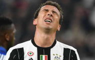 Juventus thiệt quân trước thềm trận đấu với Lyon