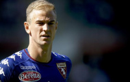 'Joe Hart làm chúng tôi ngạc nhiên'