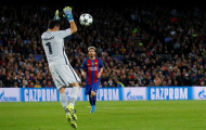 Cái tay của Bravo làm bẽ mặt Pep Guardiola