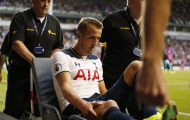 Đấu Arsenal, Harry Kane xuất trận ngay từ đầu
