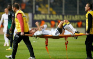 Van Persie chấn thương mắt kinh hoàng suýt mù mắt